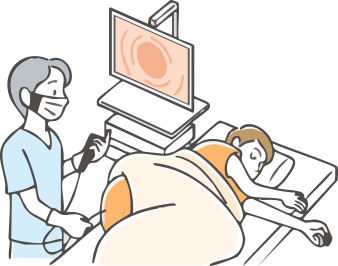 大腸カメラ検査