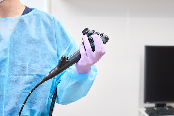 内視鏡検査の特徴は？